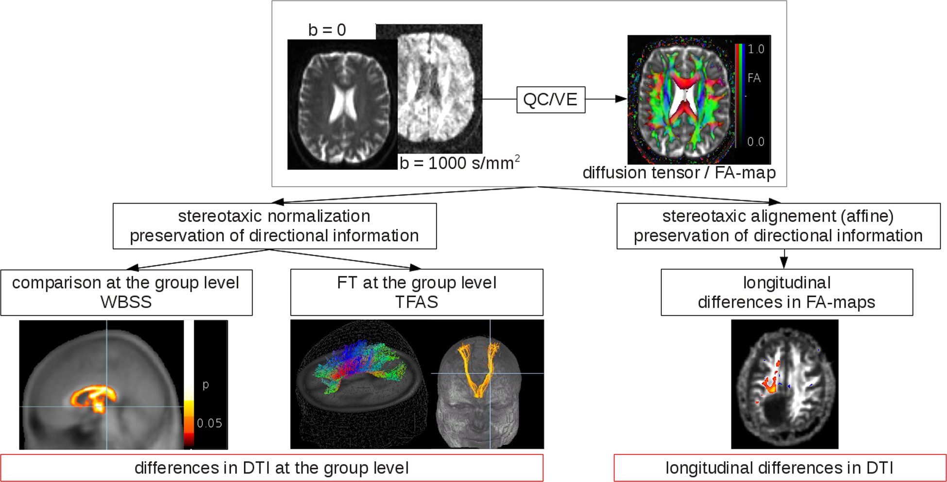 Diffusion Tensor Magnetic Resonance Imaging in the Analysis of ...