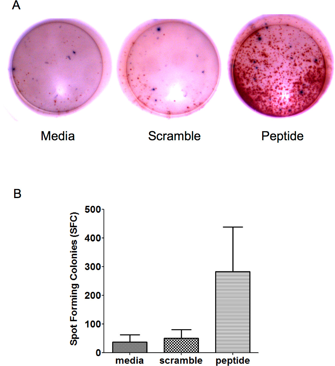 Induction of Invasive Transitional Cell Bladder Carcinoma in Immune ...