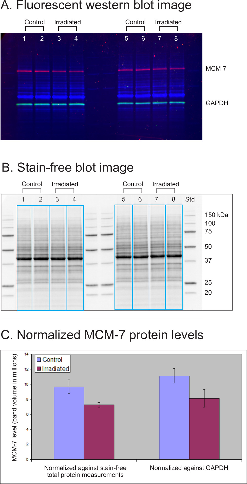 V3 Stainfree Workflow for a Practical, Convenient, and Reliable Total
