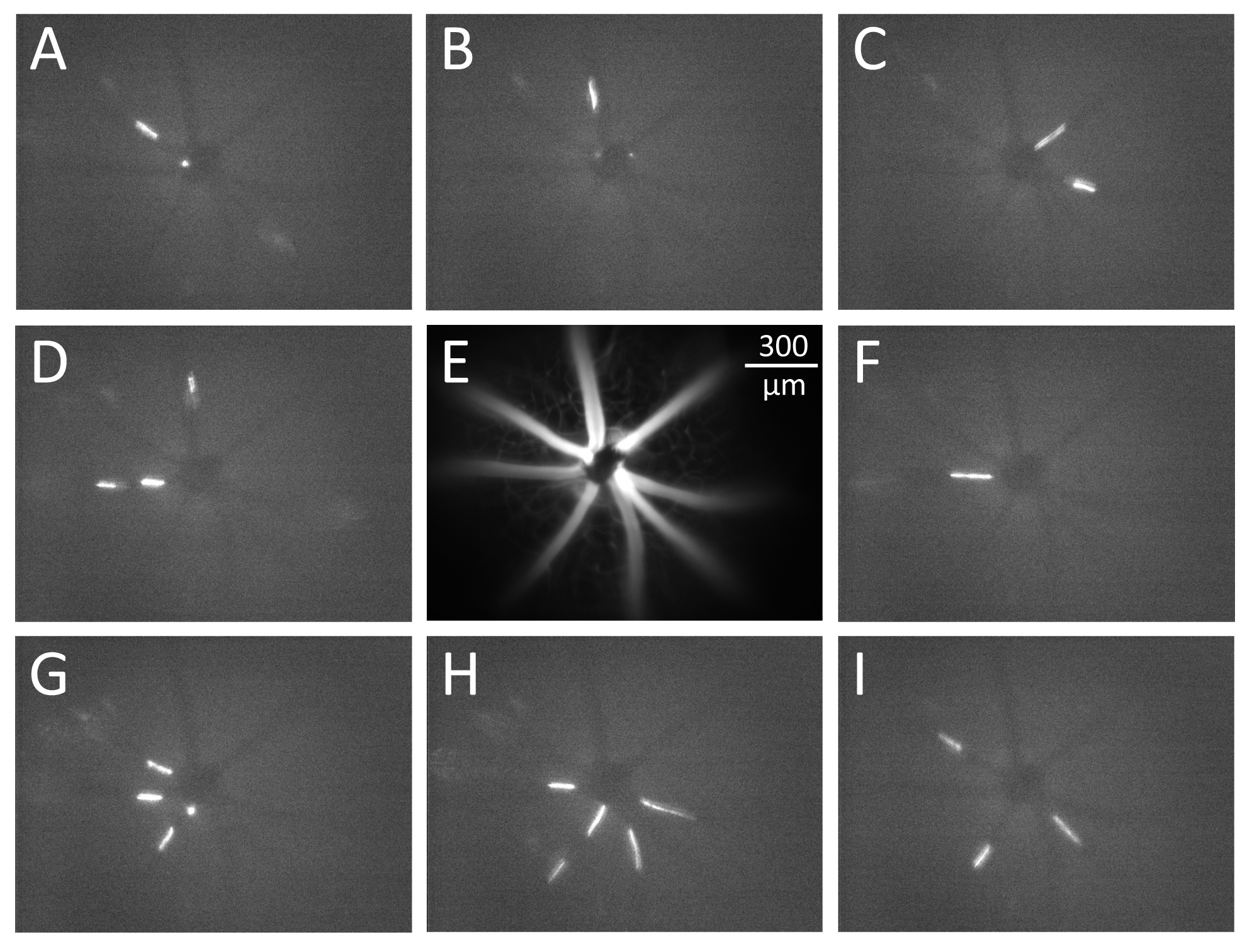 Intravital Video Microscopy Measurements Of Retinal Blood Flow In Mice Intravital Video Microscopy Measurements Of Retinal Blood Flow In Mice