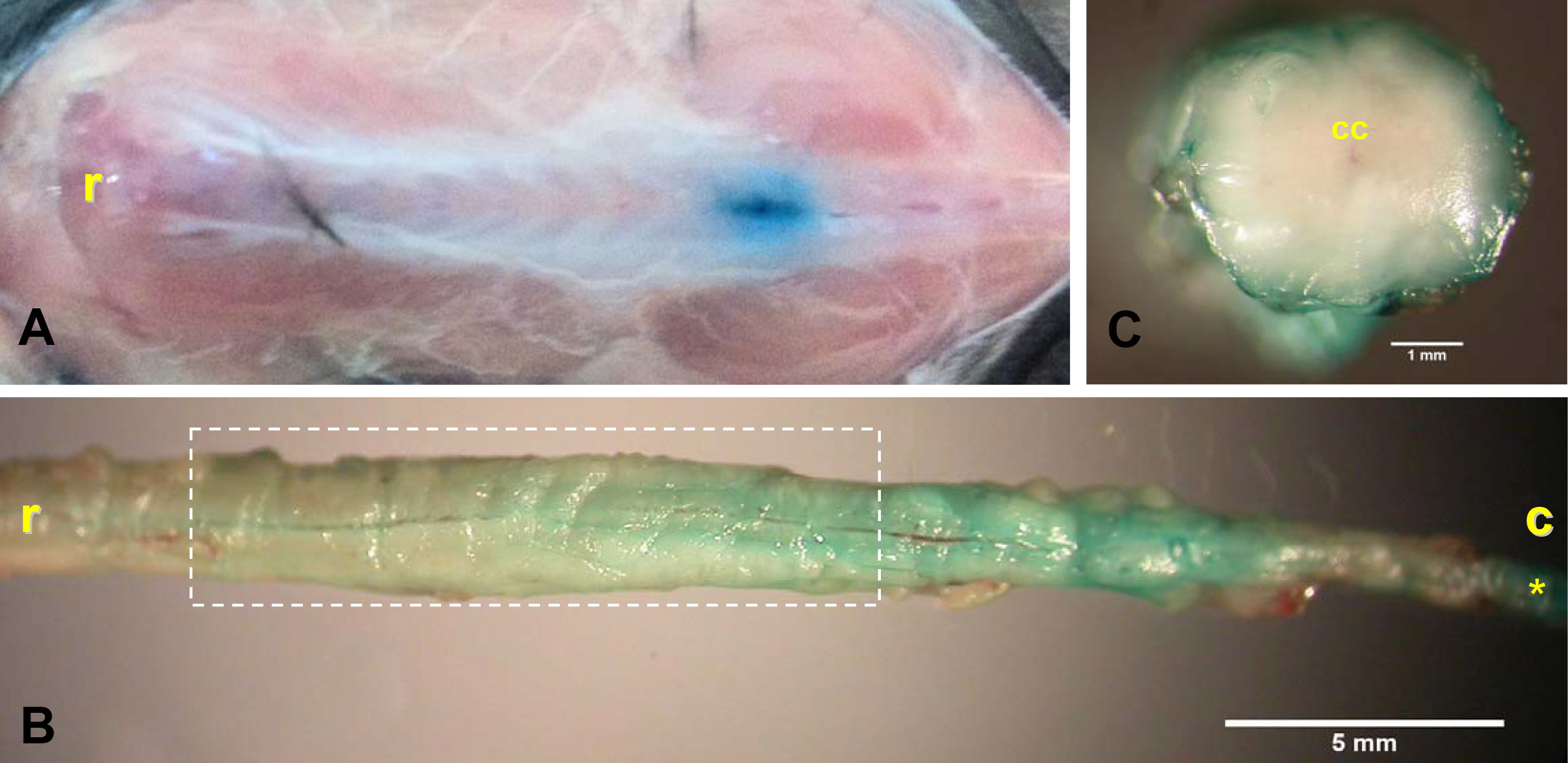 In Vivo SiRNA Transfection and Gene Knockdown in Spinal Cord via Rapid ...