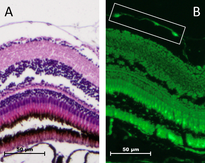 Figure 13