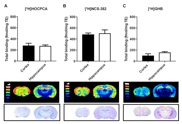 Autoradiography As A Simple And Powerful Method For Visualization And Characterization Of Pharmacological Targets Protocol Translated To Japanese