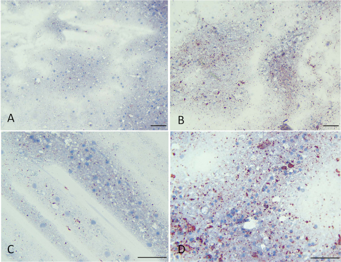Enhanced Rabies Surveillance Using A Direct Rapid Immunohistochemical Test Protocol Translated To Chinese Enhanced Rabies Surveillance Using A Direct Rapid Immunohistochemical Test Protocol Translated To Chinese