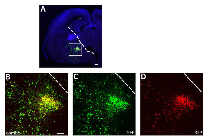 Transplantation of Chemogenetically Engineered Cortical 