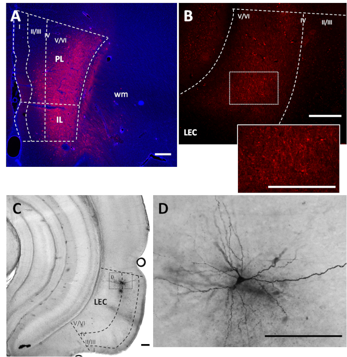 Ex Vivo Optogenetic Interrogation of Long-Range Synaptic