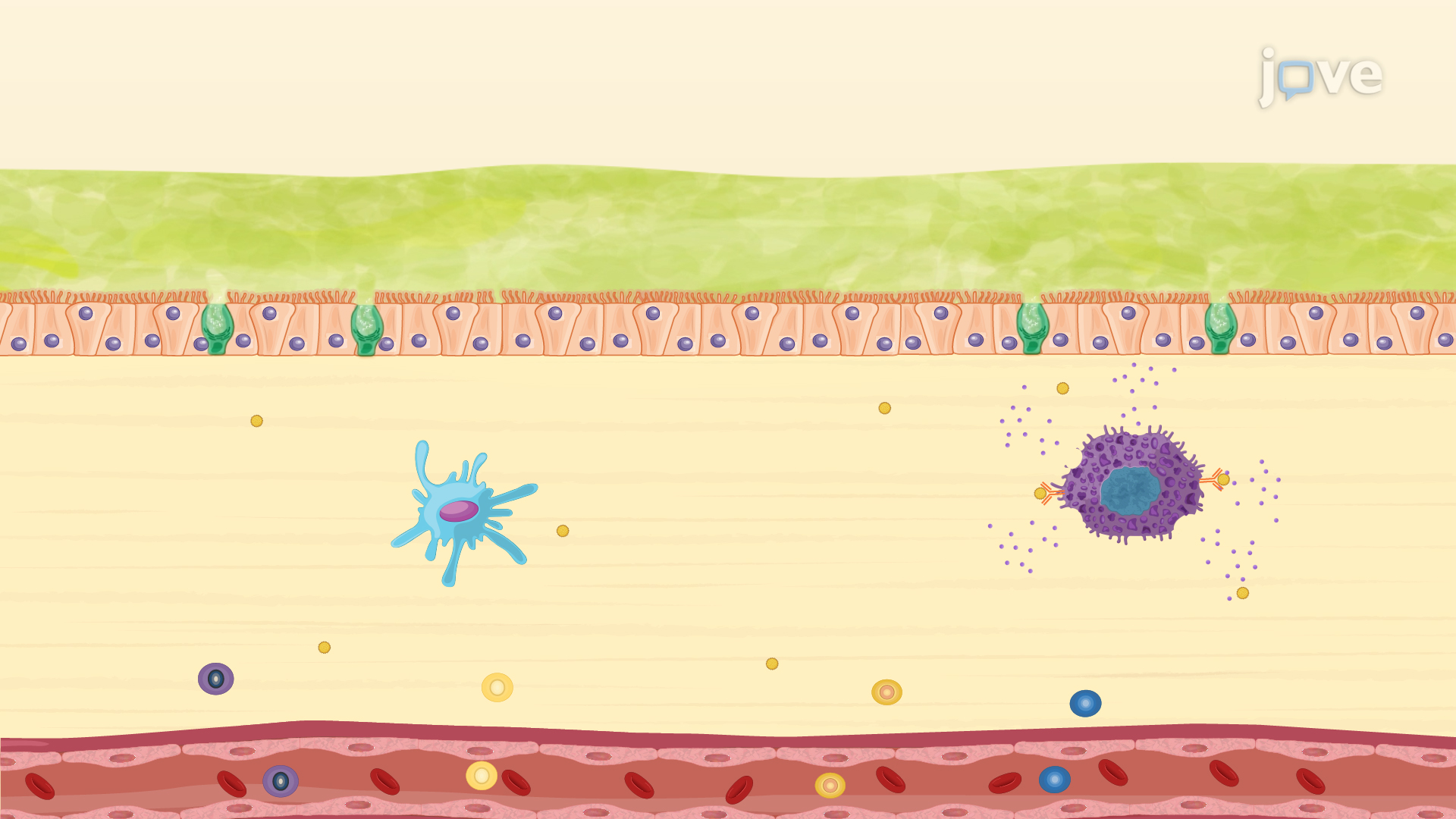 Lower Respiratory Disorders